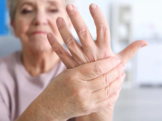 Rheumatoid Arthritis (RA)